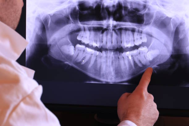 Best 24-Hour Emergency Dentist in Beale Af, CA